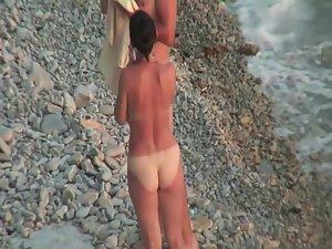 Sunburned woman is naked on a beach Picture 7