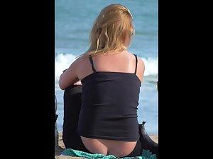 Exposed ass crack and a big pimple Picture 1