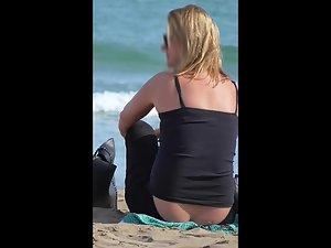 Exposed ass crack and a big pimple Picture 7